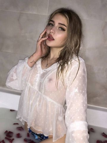 Альбина
